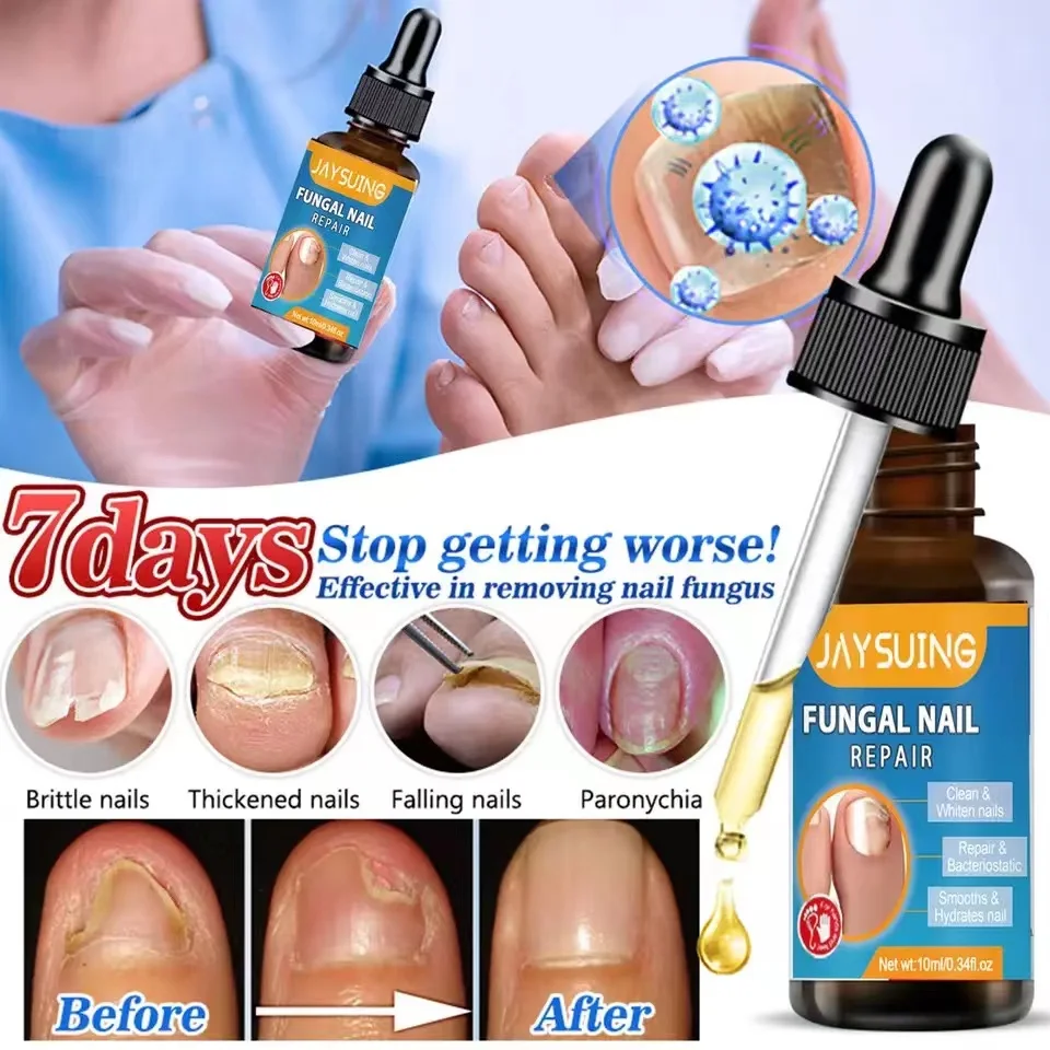 JAYSUING Nail Fungal Treatment Feet Care Essence Repair Nail Fungus