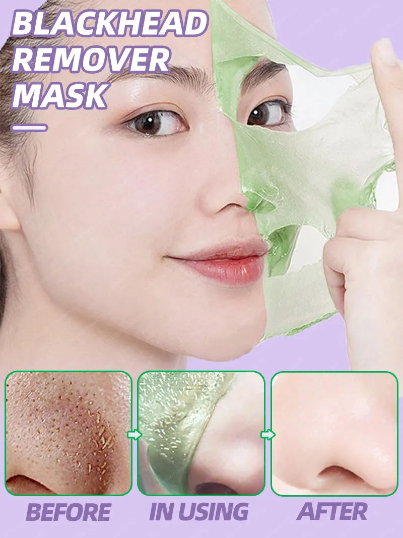BlackheadRemoverMaskRemoveBlackDotsOpenPoresCleaningShrink