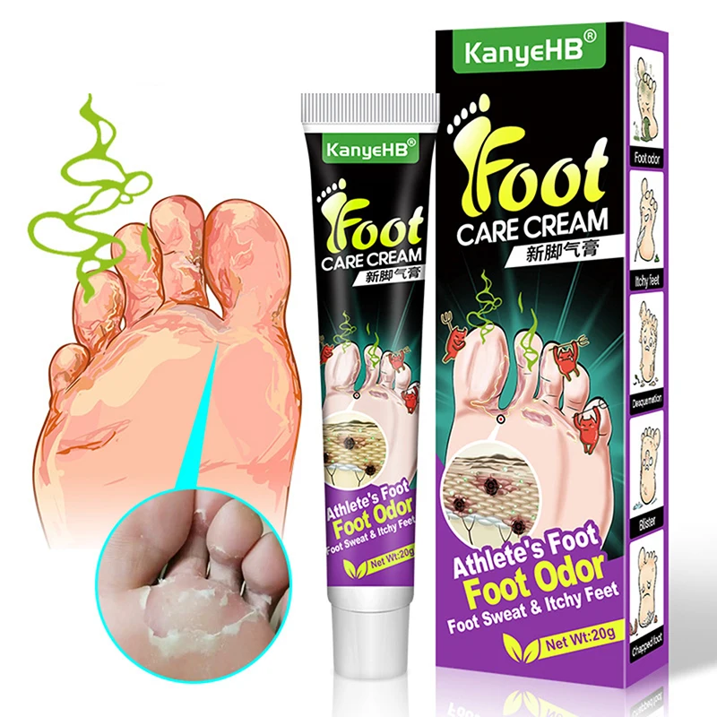 20g Anti Fungal Beriberi Foot Cream Treatment Anti Fungal Infection Feet Repair