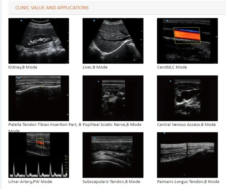 Рисунок 4 - Медицинские ультразвуковые инструменты/Chison
