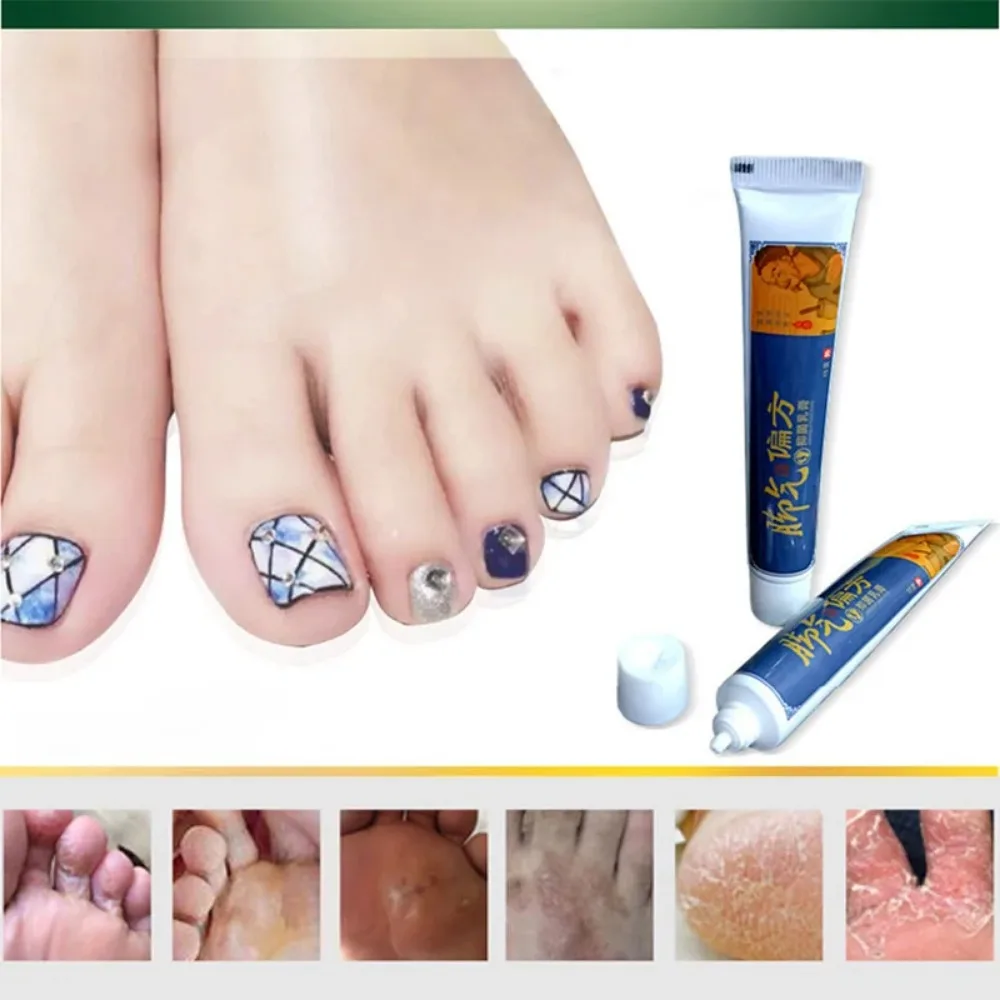 Nail Fungus Remover Foot Anti-Fungus Cream