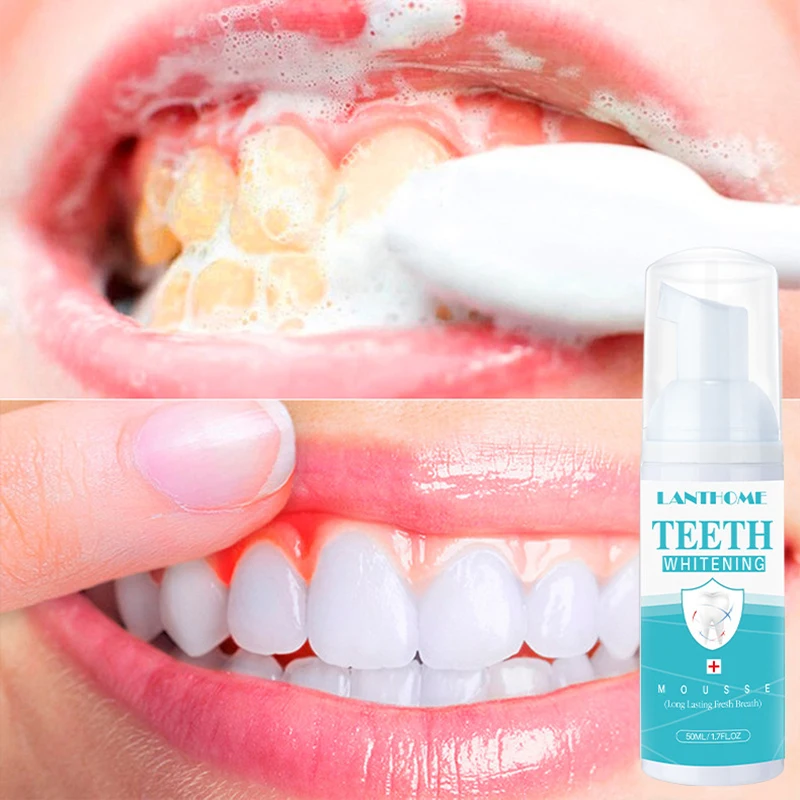 

Teeth Whitening Mousse Foam Toothpaste Plaque Stains Removal Cleaning Oral Hygiene Fresh Bad Breath Dental Bleaching Tools Care