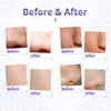 Diamond Tip Dermabrasion Microdermabrasion Machine Skin Rejuvenation Acne Remove Water Spray Facial Peeling Machine 5