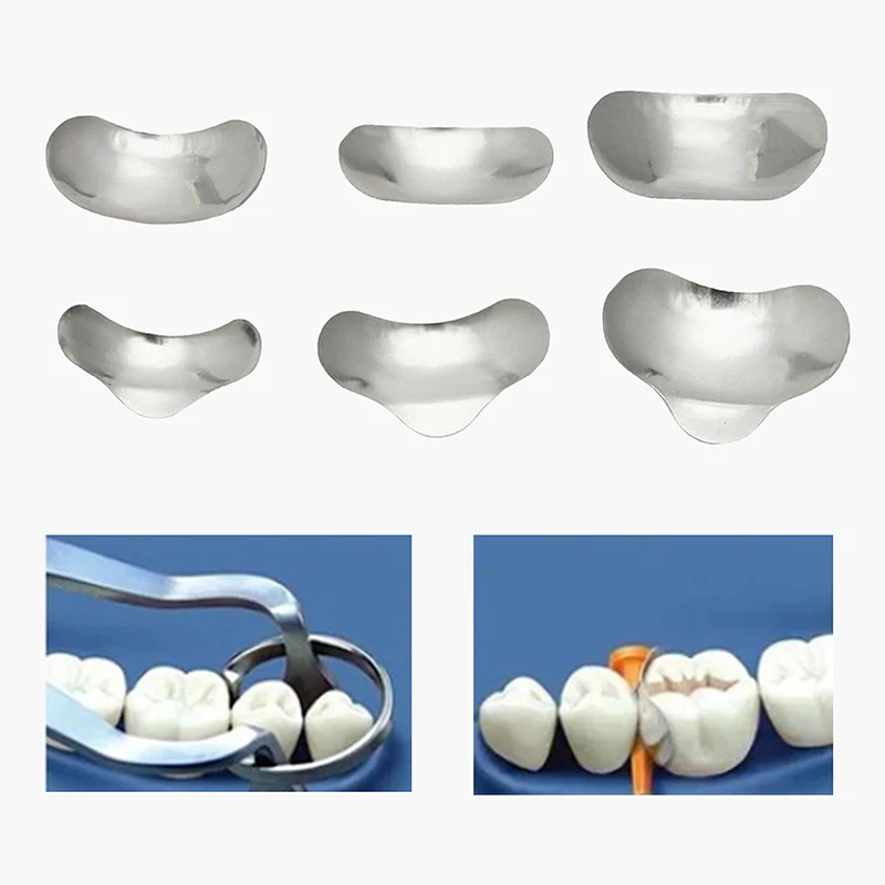 

100pcs/set Dental Sectional Contoured Matrices Matrix Ring Delta Wedges Filling Metal Matrices Bands Dental Matrix