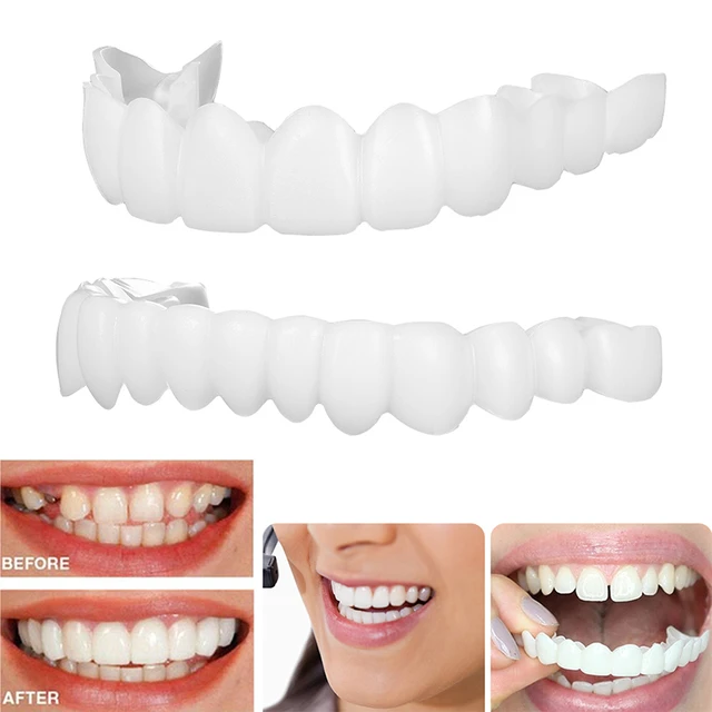 Fausses dents en Silicone, couverture supérieure et inférieure, facettes  dentaires, dentier, dentier, dentier, blanchir - AliExpress