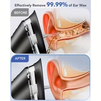 Nettoyeur d'oreilles électrique avec trois modes de pression, batterie rechargeable, double réservoir d'eau et plusieurs embouts pour usage domestique 3
