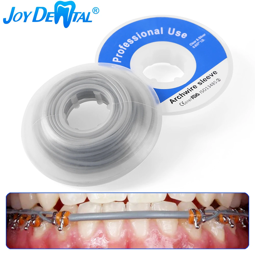 Arch Wires In Orthodontics ubicaciondepersonas.cdmx.gob.mx