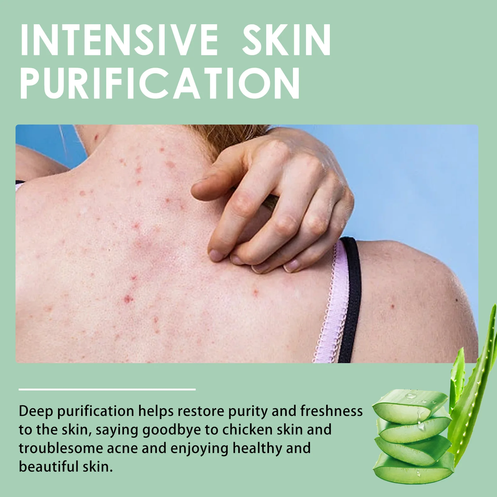 Chicken Skin Repair Cream Curing Body Keratosis Pilaris Remove Acne Spots Rough Bumpy Pores Moisturizing Smooth Whitening Lotion 4