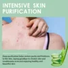Chicken Skin Repair Cream Curing Body Keratosis Pilaris Remove Acne Spots Rough Bumpy Pores Moisturizing Smooth Whitening Lotion 4