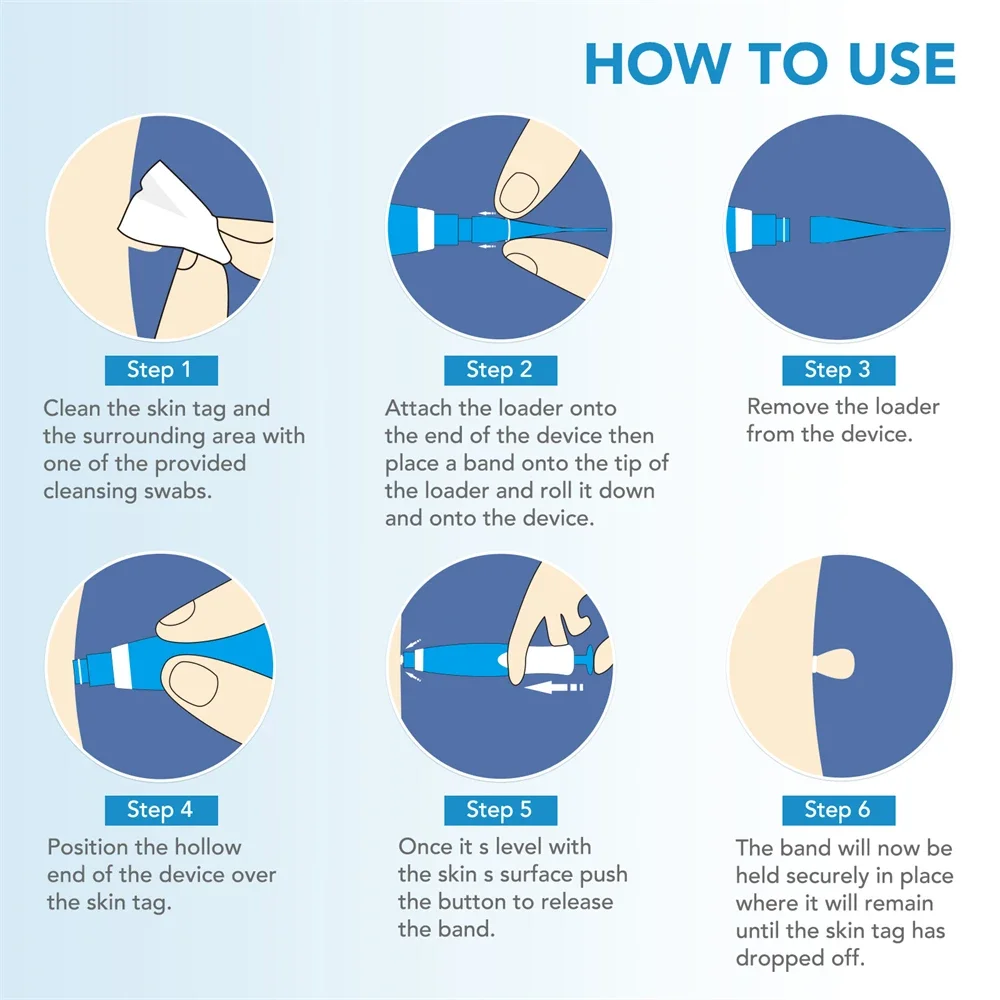 2-in-1 Skin Tag Remover Kit 5