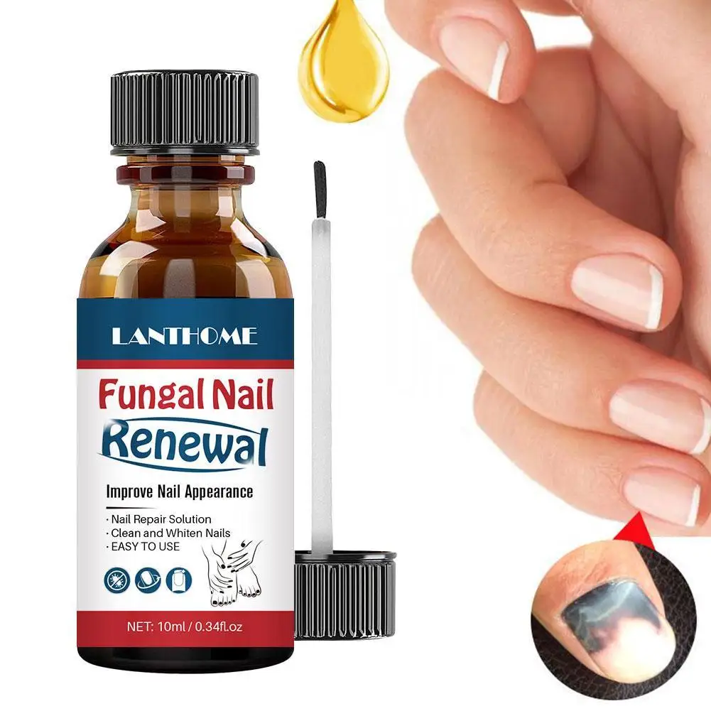 10ml LANTHOME Nail Fungal Treatment Feet Care Essence Anti Infection Paronychia Onychomycosis Foot Toe Nail Fungus Removal