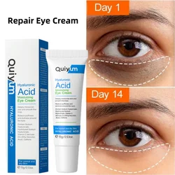 New Eye Dark Circles Remover Cream Repair Skin Barrier Fade Eyes Bag Puffiness Fine Lines Anti-aging Wrinkles Lift Firm Eye Care