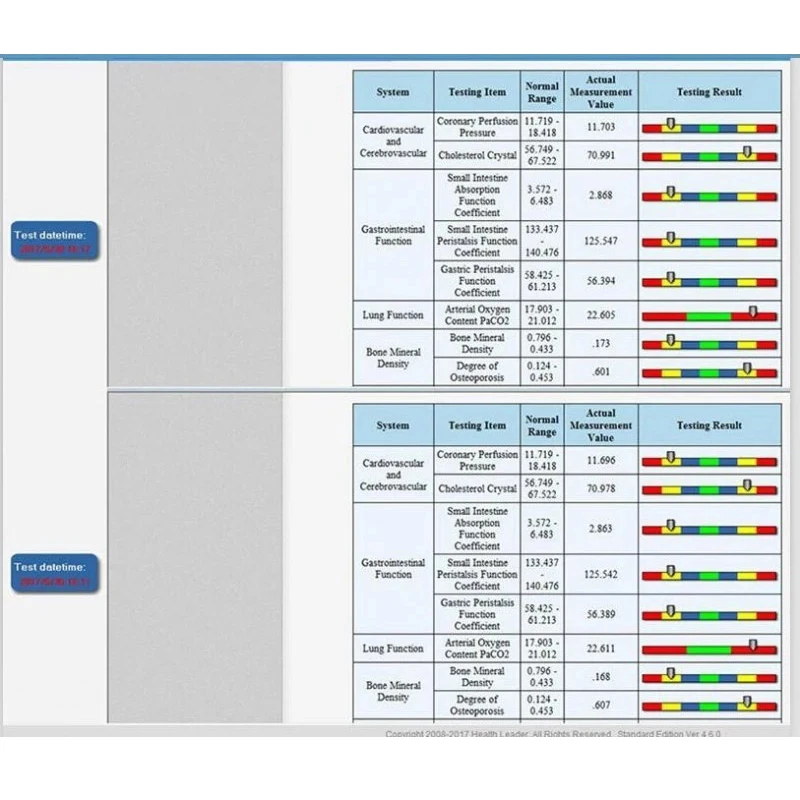 Portable Quantum Resonance Magnetic Analyzer Analytical Instrument Hand touch for Precise Detection of Human Health Indicators