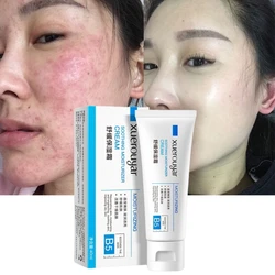 Centella Asiatica Multi-Effect Face Cream Eliminate Spider Veins B5 Soothing Hydrating for Sensitive Skin Moisturizing Skincare