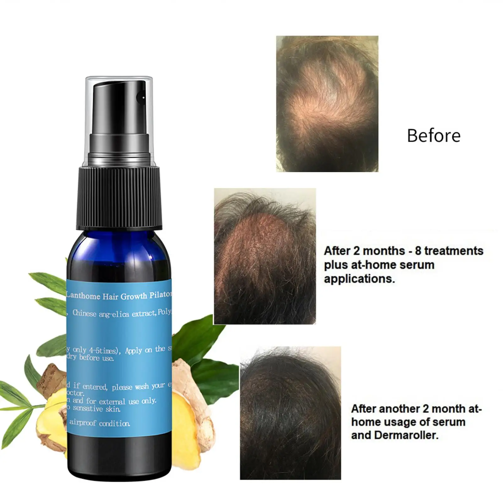 Hair Beauty Dense Serum Oil Natural Ginger Health Care Repairs Follicles