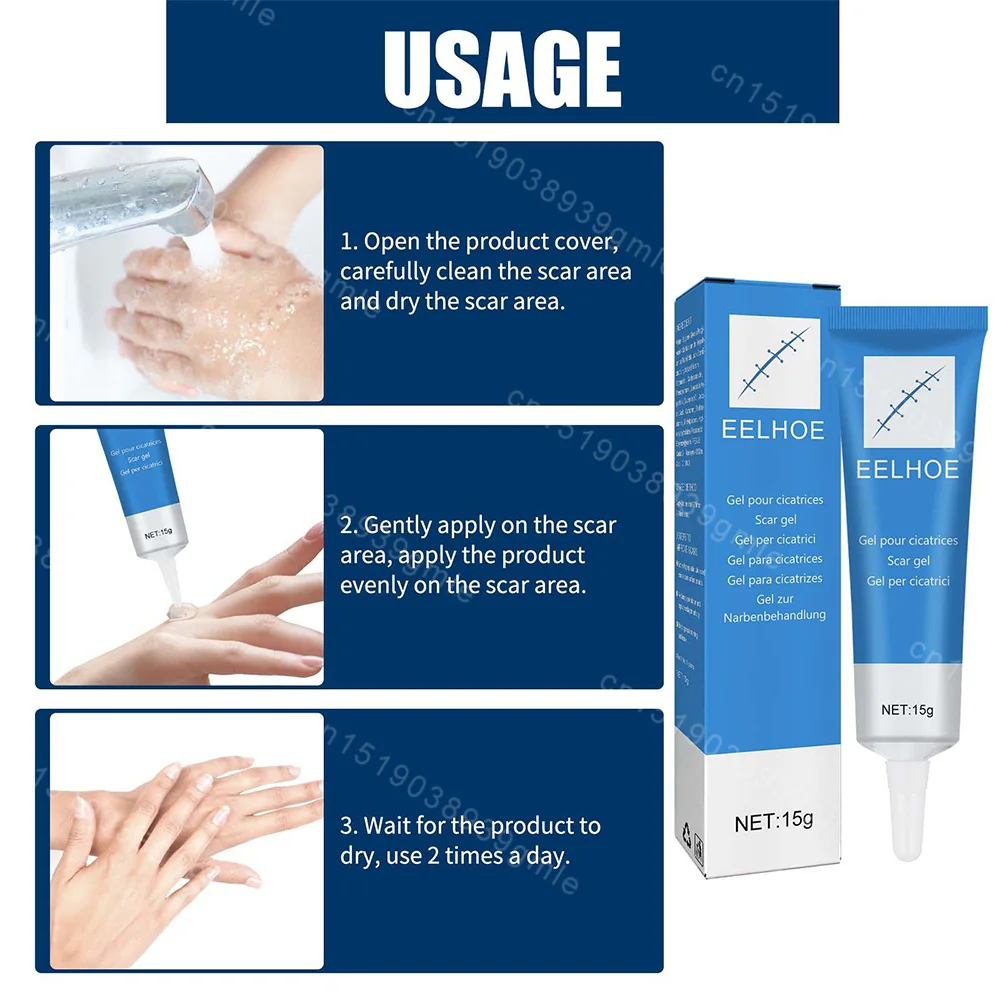Recovery Scar Cream Fast Removal Skin Scars Treat Surgery Scars Stretch Marks Acne Pox Prints Burn Repair Facial Care Gel pain analgesic cream