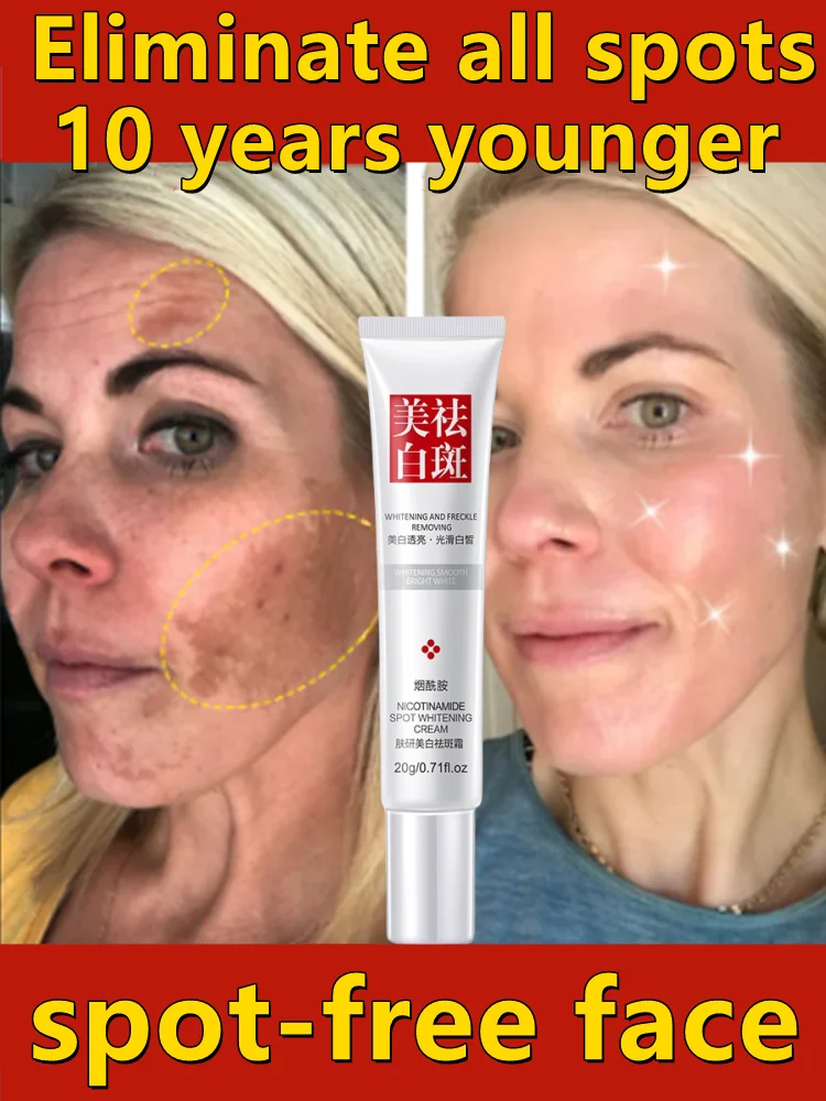 

Dark Spots Cream Fast Whitening Freckles Age Spots Lighten Pigment Correction Brighten Black Skin Facial Care Products Men Women