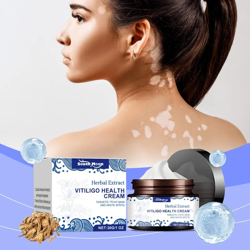 Vitiligo Treatment Cream Melanin Growth Cream Remove White Spot Eliminate Vitiligo Antibacterial Body Skin Care vitiligo ointment