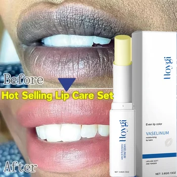 Instantly Lip Balm Remove Dark Lighten Melanin Lip Mask Fade Lip Line Brighten Exfoliating Moisturize Dead Skin Repair Lip Care 1