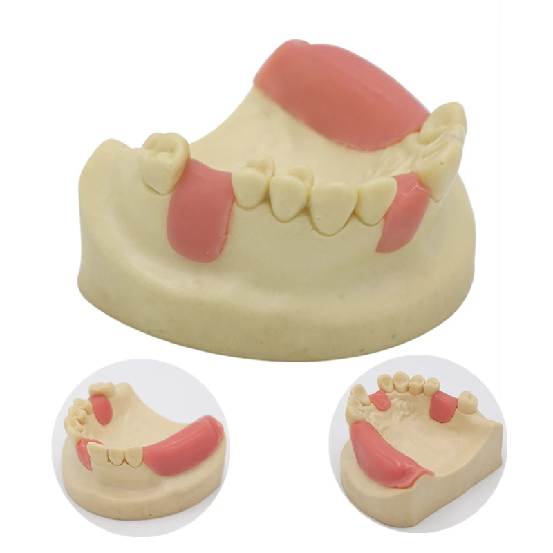 YOUYA 1PCS Dental Model Teeth Implant Practice Model Tooth Dental Implant Model Training Display  Dentistry Oral Teaching Models