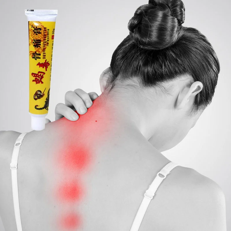 

1pcs Scorpion Venom Pain relief orthopedic Ointment Analgesic Cream medical Muscle aches Waist Neck pain Arthritis Arthralgia