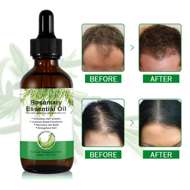 Description Picture 6 of itemY1UF Hair Growth Serum Hair Growth Oil for Women and Men Thicker Growth Hair for Dry Damaged Hair Stop Hair Thinning