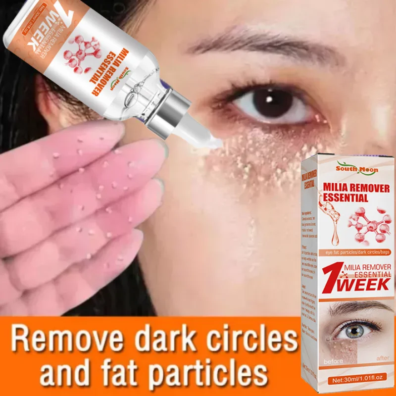 Fat Granules Removal Eye Serum Eye Milia Repair Treatment Products Wrinkle Lifting Moisturizing Anti-Puffiness Korean Skin Care facial serum facial essence retinol face serum salicylic acid facial serum