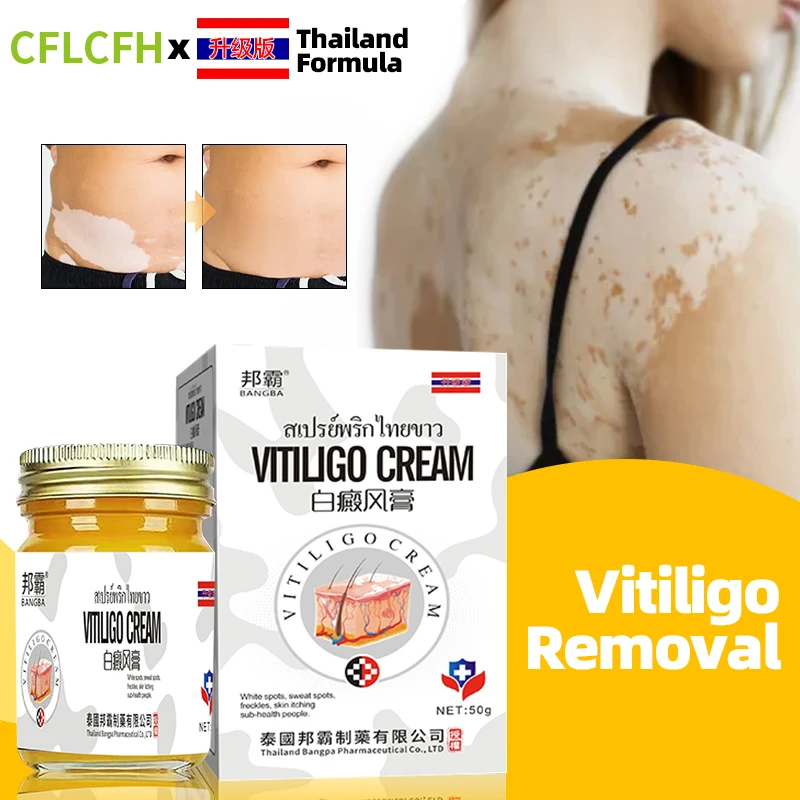 

Thailand Vitiligo Skin Treatment Cream White Spot Remover Medicine Promote Melanin Repair Leg Leukoplakia Removal
