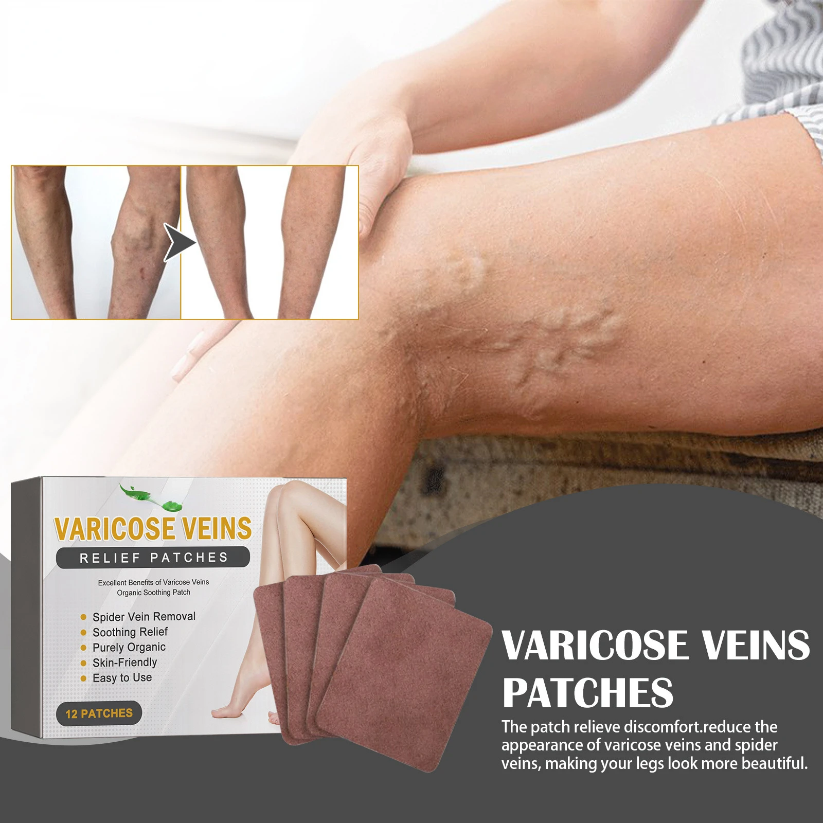 

Венозная кожа, восстанавливает сосудистые выступания на ногах земляного червя, отек ног, здоровое средство, венозная кожа