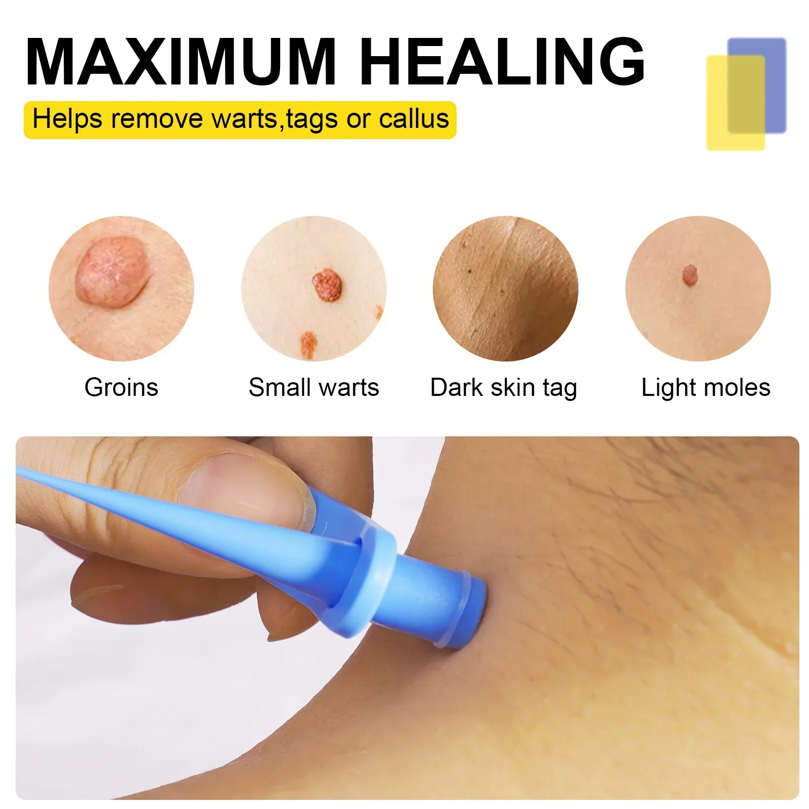 2-IN-1 Wart Removal Kit Meat Polka Dots Warts Acne Flesh Mole Face Pot Fast Removal Kit Unisex Body Skin Tag Care Tools