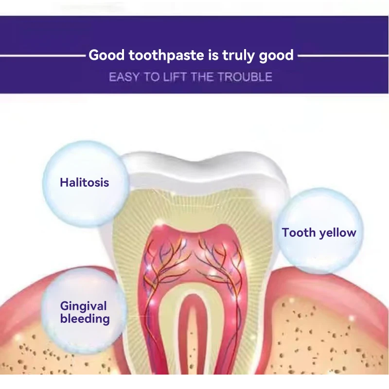 Whitening Teeth Remover Dental Calculus Mouth Odor Removal Bad Breath Preventing Periodontitis Remove Oral Stains Tooth Care
