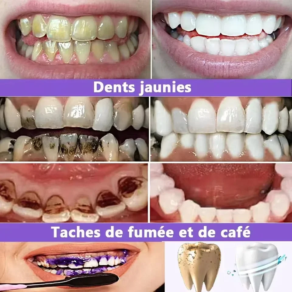 Teeth Whitening Product Teeth Whtening Toothpaste Pen Remove Plaque Stains