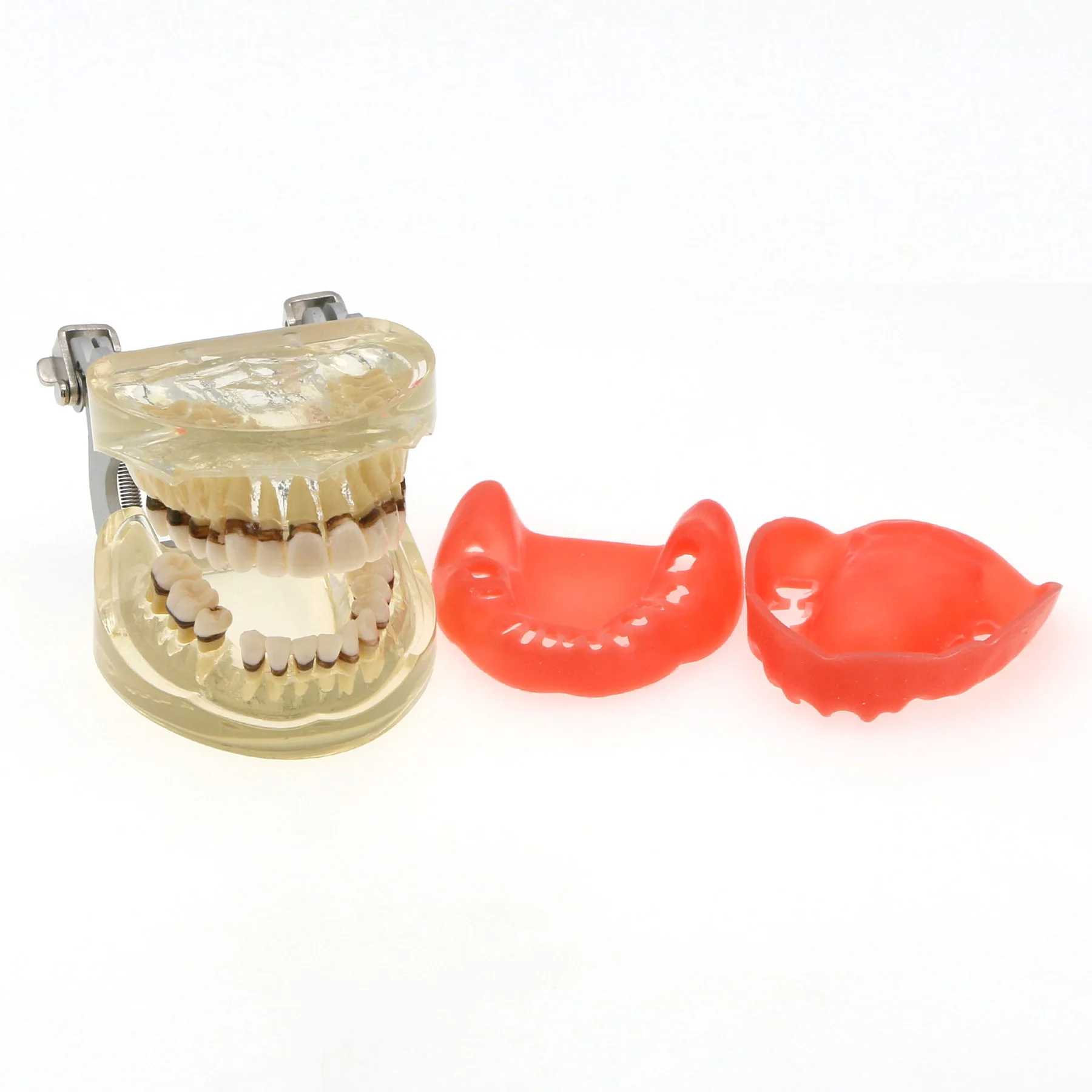 Dental Teeth Model  Dentist Teaching Model Demonstration Periodontal Disease Pathological For Patient Education Demo M4017 6