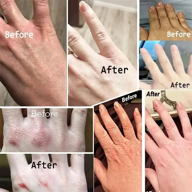 Dark Knuckles Fast Brighten Serum Skin Cracked Soft Moisturizer Hand Cream Elbows Knee Black Skin Lighten Stains Remover Product 3