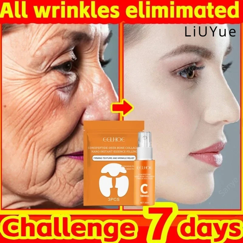 

Коллагеновая Сыворотка для лица для удаления морщин, набор патчей, антивозрастной, подтягивающий, укрепляющий, выцветающий, отбеливающий, Восстанавливающий уход за кожей, маска для лица