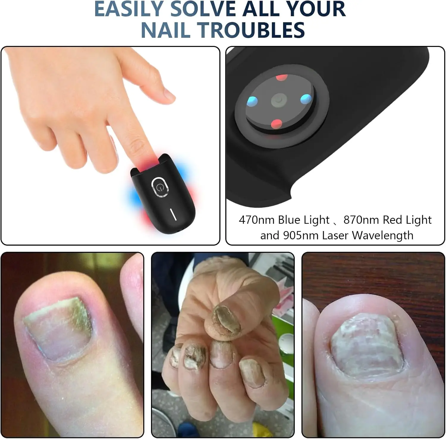 Professionelles Lasergerät Zur Nagelpilzbehandlung Mit Lichttherapie_voghion.com