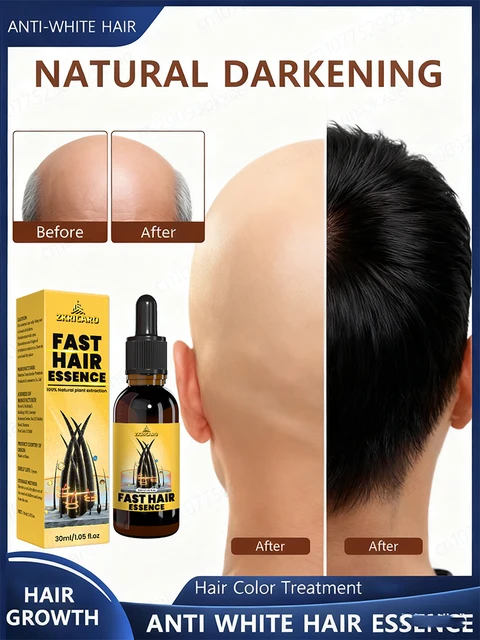 สูตรอ่อนโยนเหมาะสำหรับหนังศีรษะที่บอบบาง บำรุงอย่างล้ำลึกโดยไม่ระคายเคือง ทำให้ผมดูมีชีวิตชีวาอย่างเป็นธรรมชาติ 1