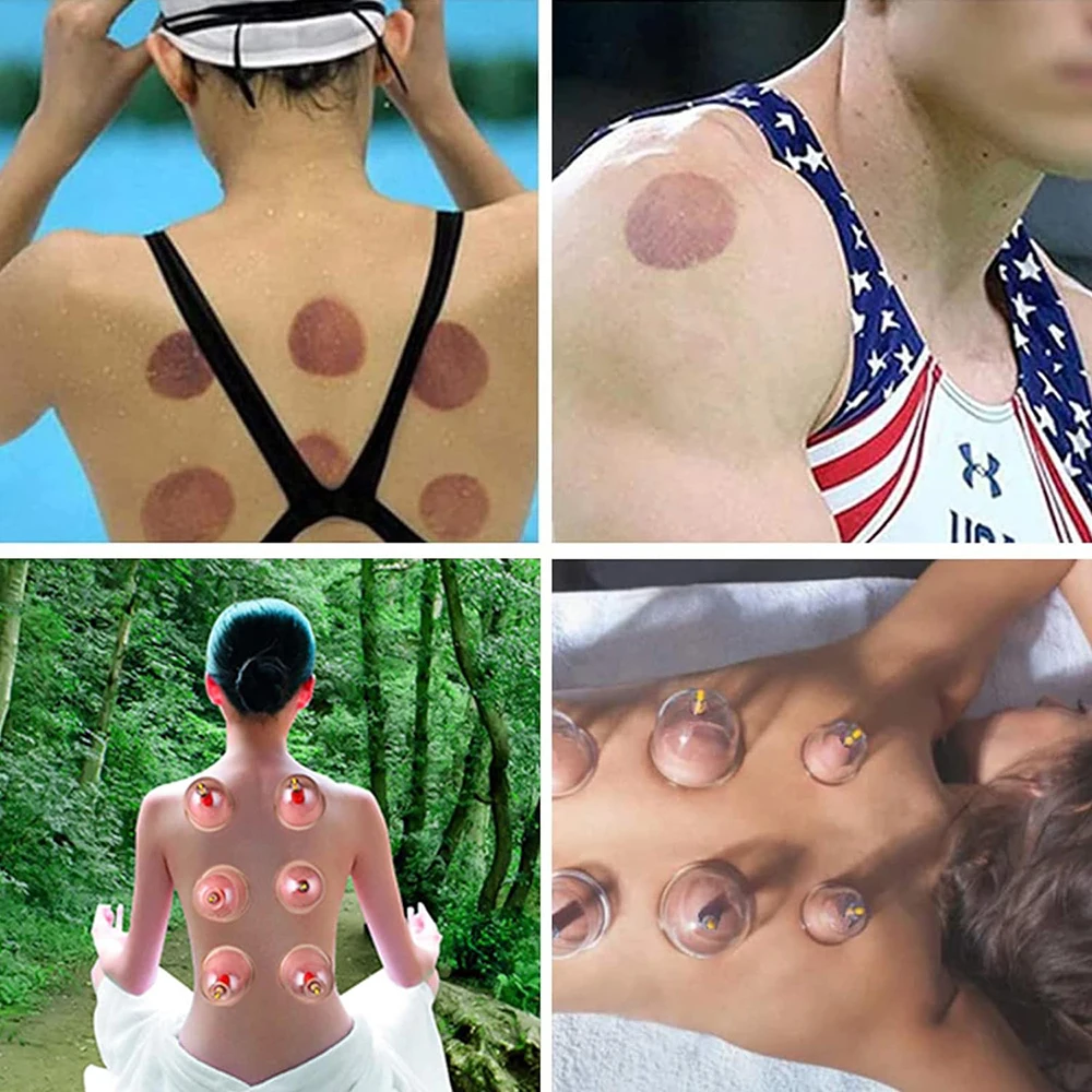 32 Can Household Thickened Vacuum Cupping Machine Non Glass Cupping Machine Health Massage Tool vacuum cupping sets