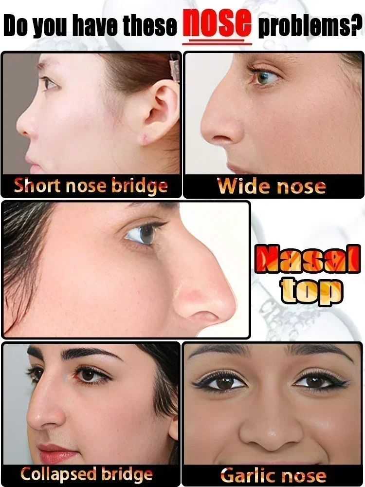 Rhinoplasty Essential Oil Shaping Nasal Bone Reshaping, Natural Care for Small Nose Height Rhinoplasty Surgery Glutathion