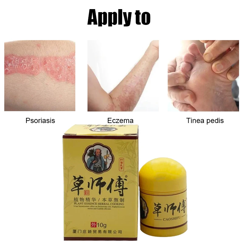 Natural Psoriasis Ointment Treat Dermatitis Eczema Antipruritic Dressing Eczematoid Skin Repair Antibacterial Cream 4pcs 10g