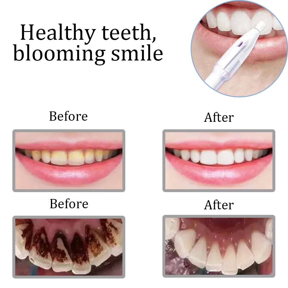 Рисунок 2 - 5 в 1, электрическая машинка для