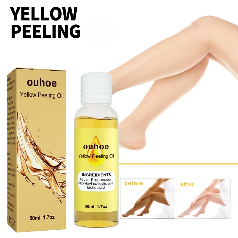 

Yellow peeling oil strong Brightening exfoliating oil Lighten elbows knees hands melanin spots even skin tone whiten skin care