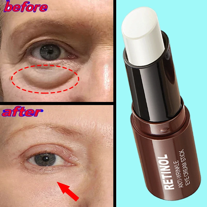 Retinol Stick Anti-Wrinkle Eye Cream Get Rid Puffy Dark Circles Moisturizing Lift Fine Lines Whitening Health Repair Eye Care line repair fix retinol e active cream