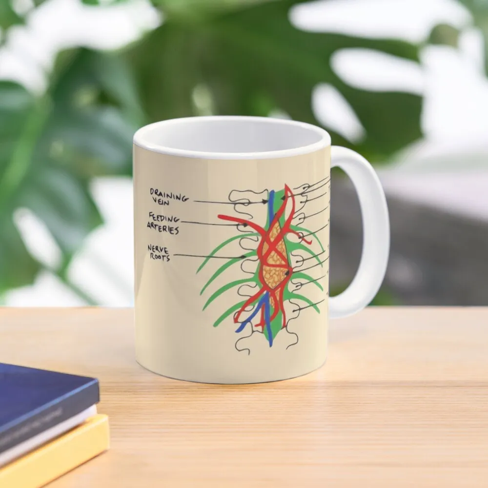 

Tumor Coffee Mug Large Tea Cups Customizable Cups Thermal For Mug
