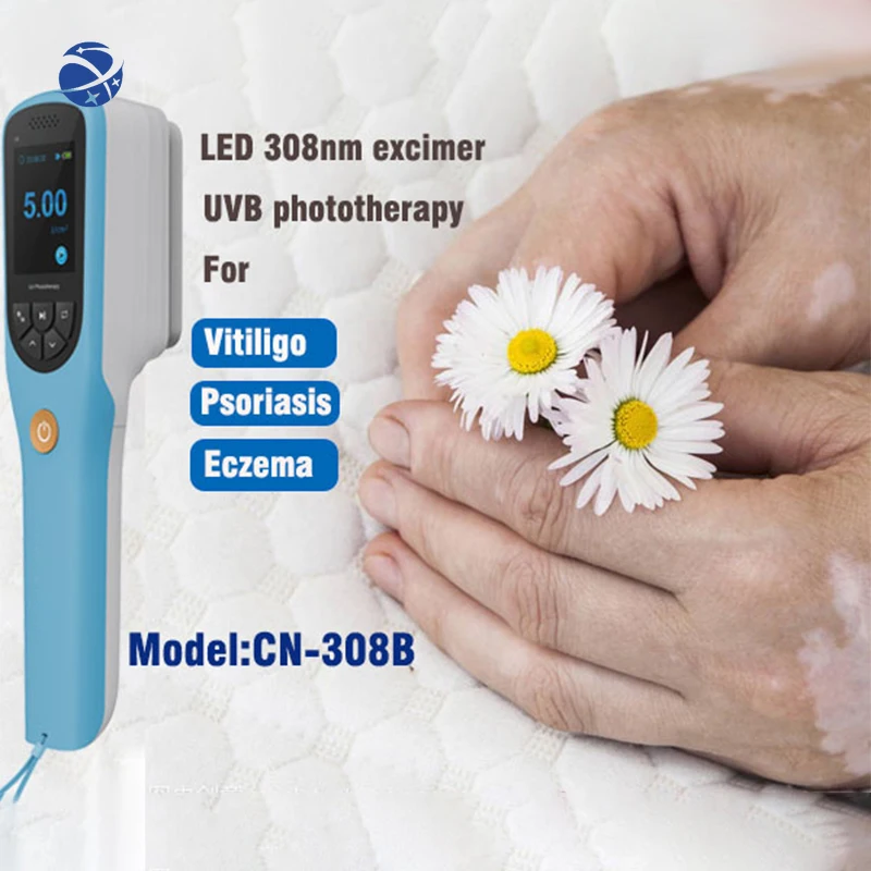 yyhcnew design excimer laser 308nm psoriasis laser uv lamp home portable uvb lamp phototherapy for psoriasis