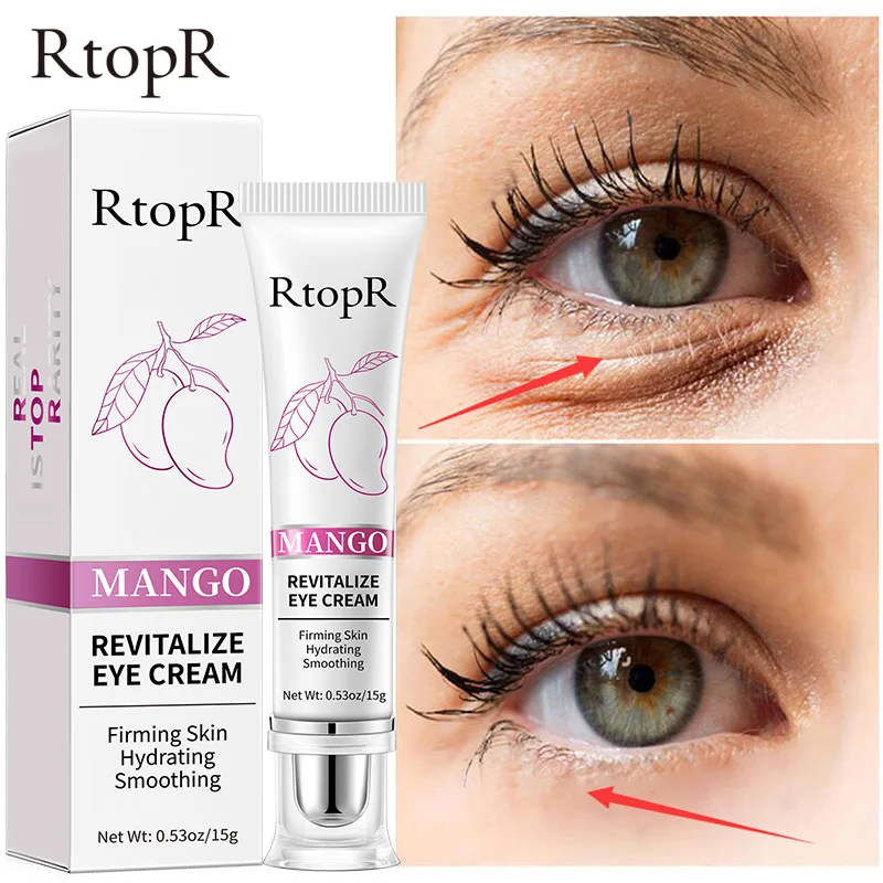 RtopR Mango Eye Cream to remove dark circles Anti-Puffiness Eliminate eye puffiness Smoothing Firming Skin Eye Treatment Cream