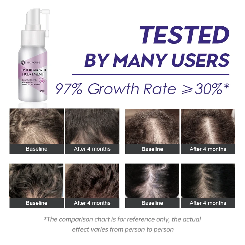 Hair Growth Spray Fast Hair Grow Essential Oil For Men/women Hair Care  Products Anti Hair Loss Treatment Beauty Scalp Treatment - Hair Loss  Product Series - AliExpress