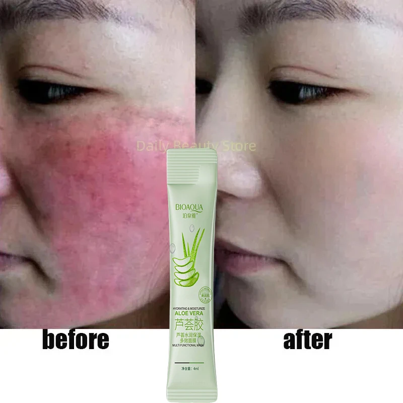 Instant Facial Redness Repair Serum Improve Sensitive Skin Anti-Allergy Products Redness Rosacea Itching Soothing Korean Care