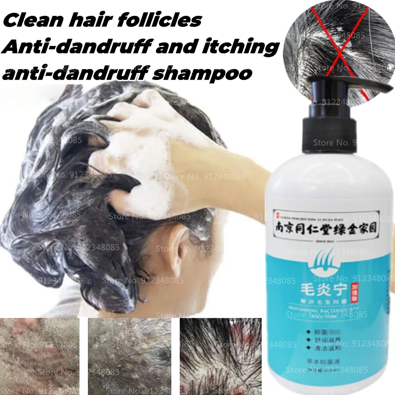 

Nanjing Tongrentang Maoyanning Herbal Antibacterial Liquid Anti-dandruff and Itching To Improve Hair Follicle Amino Acid Shampoo