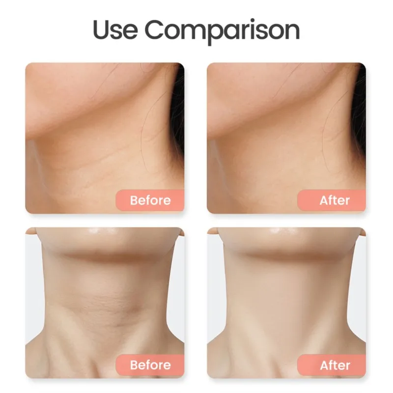 USB Electric Massager Bian Stone Heating Face Massage for Neck Tighten Lift Facial Skin Guasha Energy Stone Needle Warm Gua Sha